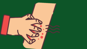 cannabis and pruritus