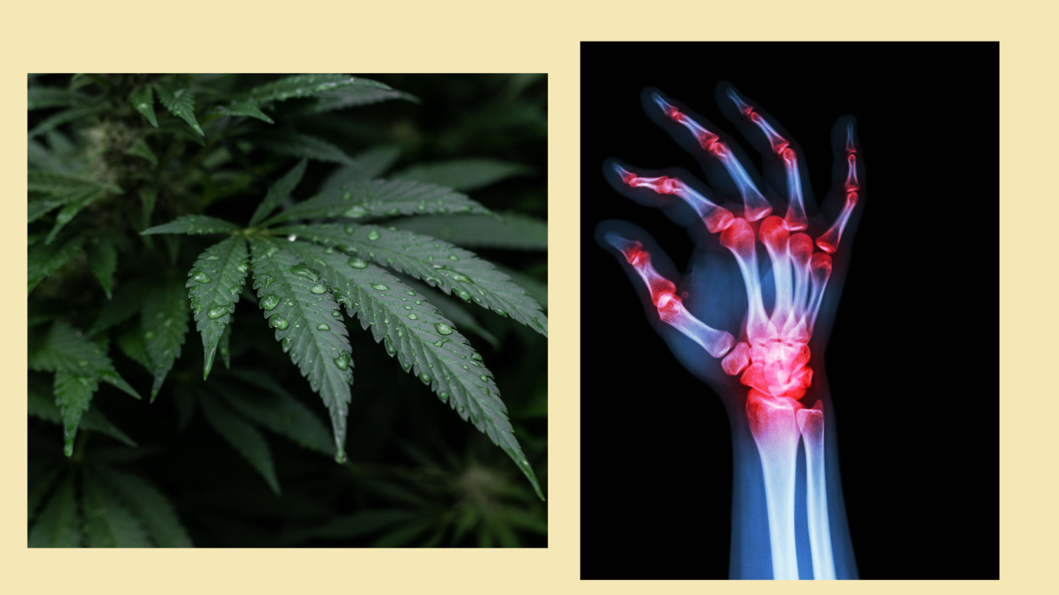 Easing the Burden: Cannabis in the Management of Arthritis - The Seed ...